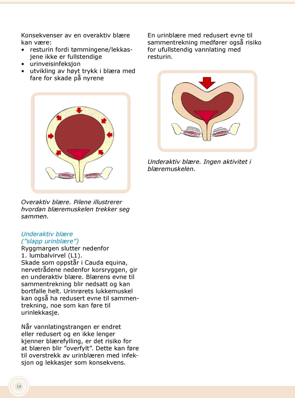Pilene illustrerer hvordan blæremuskelen trekker seg sammen. Underaktiv blære ( slapp urinblære ) Ryggmargen slutter nedenfor 1. lumbalvirvel (L1).