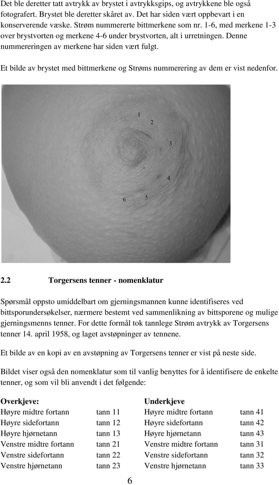 Et bilde av brystet med bittmerkene og Strøms nummerering av dem er vist nedenfor. 2.