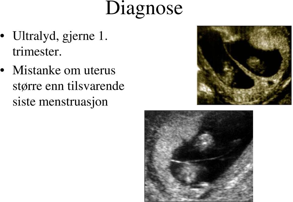 Mistanke om uterus