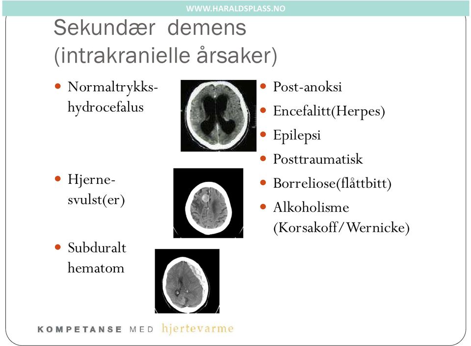 hematom Post-anoksi Encefalitt(Herpes) Epilepsi