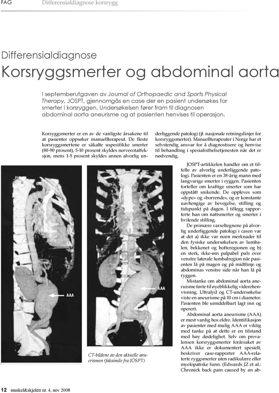 Korsyggsmerter er en av de vanligste årsakene til at pasienter oppsøker manuellterapeut.