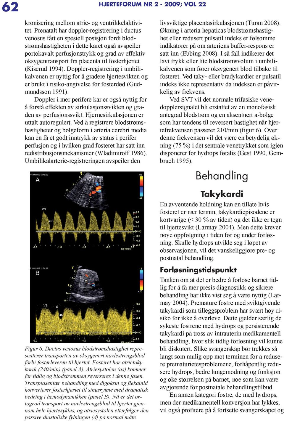 fra placenta til fosterhjertet (Kiserud 1994). Doppler-registrering i umbilikalvenen er nyttig for å gradere hjertesvikten og er brukt i risiko-angivelse for fosterdød (Gudmundsson 1991).