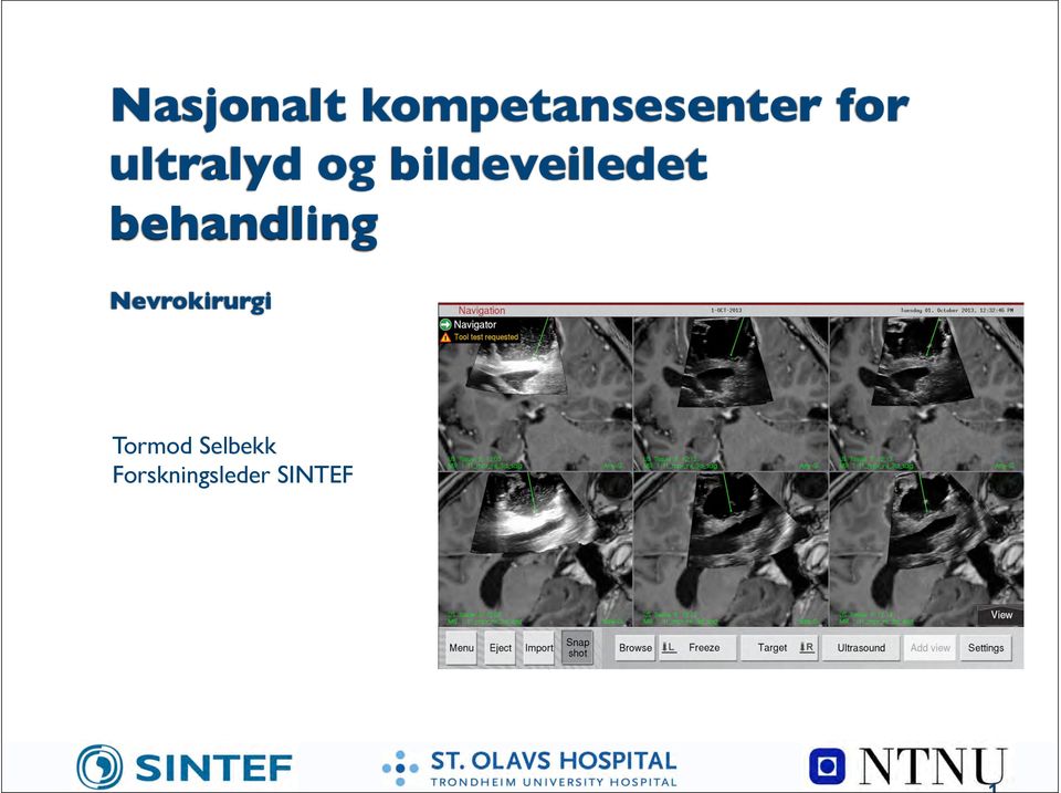 behandling Nevrokirurgi