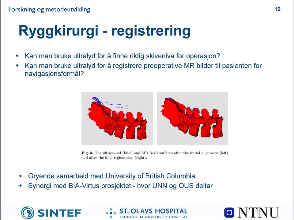 Registration of MR Images to Ultrasound Images of the Spine 7 Fig. 3.