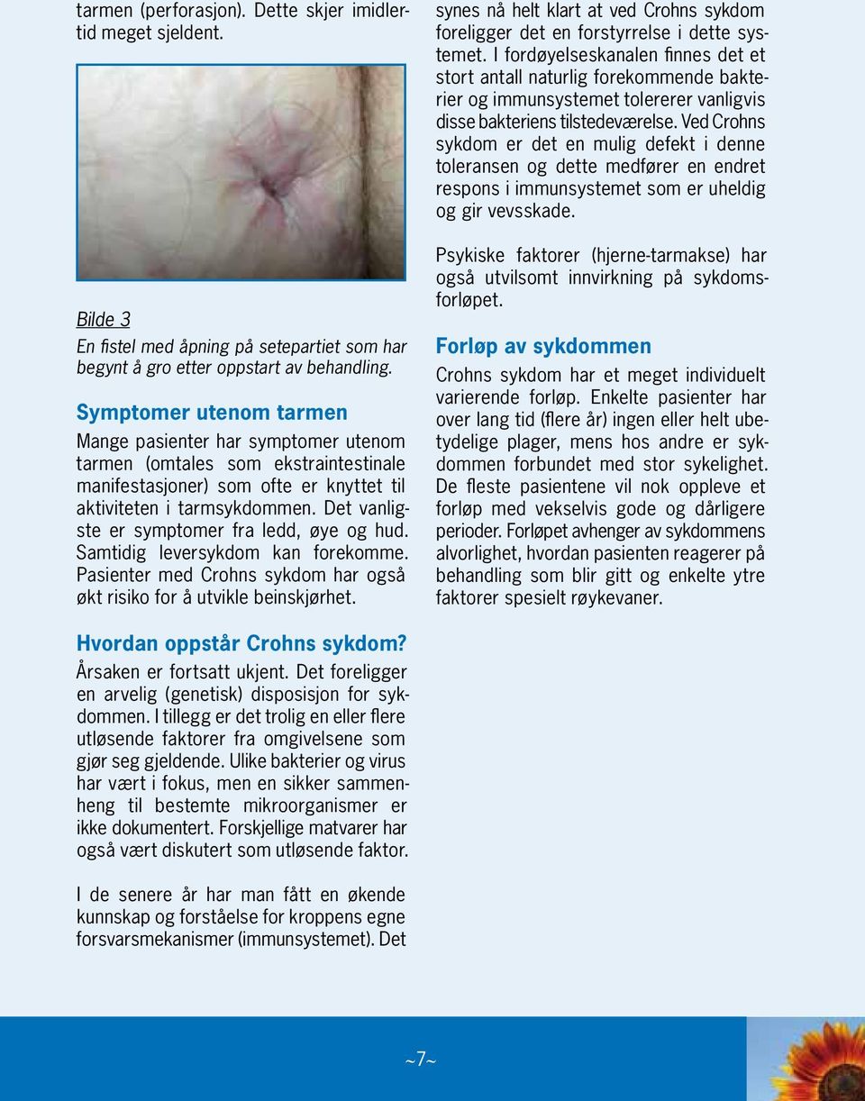 Det vanligste er symptomer fra ledd, øye og hud. Samtidig leversykdom kan forekomme. Pasienter med Crohns sykdom har også økt risiko for å utvikle beinskjørhet.