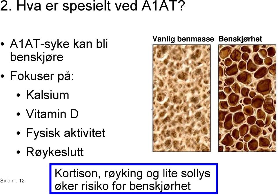 12 Kalsium Vitamin D Fysisk aktivitet Røykeslutt