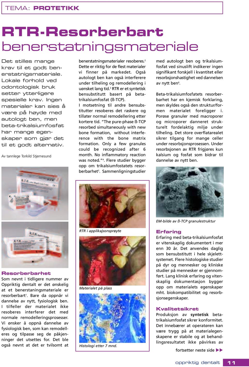 Av tannlege Torkild Stjernesund benerstatningsmaterialer resoberes. 2 Dette er riktig for de flest materialer vi finner på markedet.