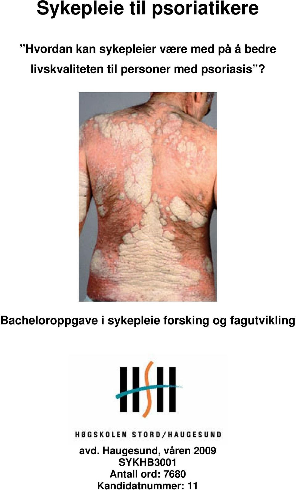 Bacheloroppgave i sykepleie forsking og fagutvikling avd.