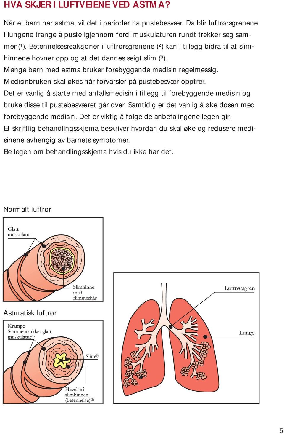 Medisinbruken skal økes når forvarsler på pustebesvær opptrer. Det er vanlig å starte med anfallsmedisin i tillegg til forebyggende medisin og bruke disse til pustebesværet går over.