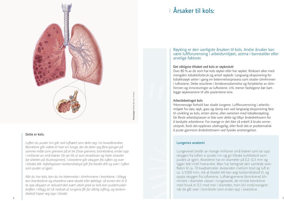 Risikoen øker med mengden tobakksforbruk og antall røykeår. Langvarig eksponering for tobakksrøyk setter i gang en betennelsesprosess som skader slimhinnen i luftveiene.