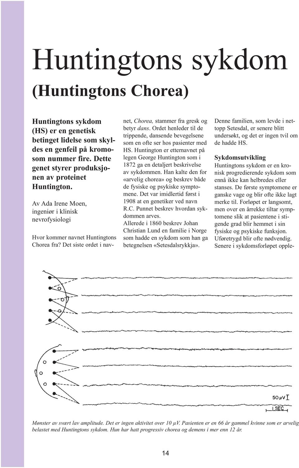 Ordet henleder til de trippende, dansende bevegelsene som en ofte ser hos pasienter med HS. Huntington er etternavnet på legen George Huntington som i 1872 ga en detaljert beskrivelse av sykdommen.