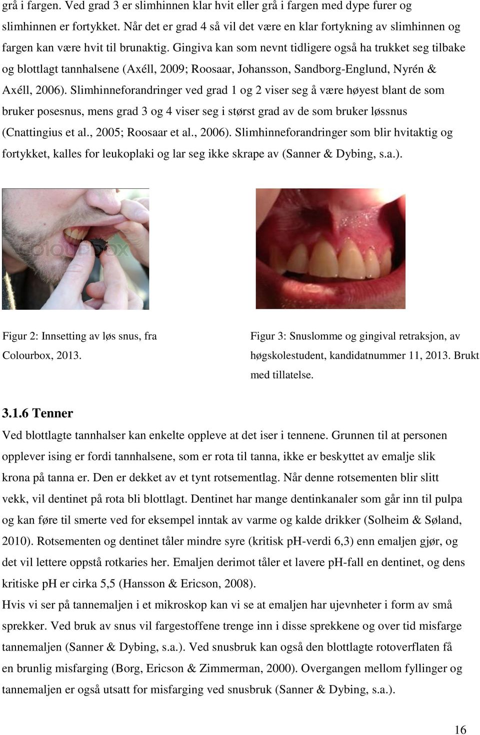 Gingiva kan som nevnt tidligere også ha trukket seg tilbake og blottlagt tannhalsene (Axéll, 2009; Roosaar, Johansson, Sandborg-Englund, Nyrén & Axéll, 2006).