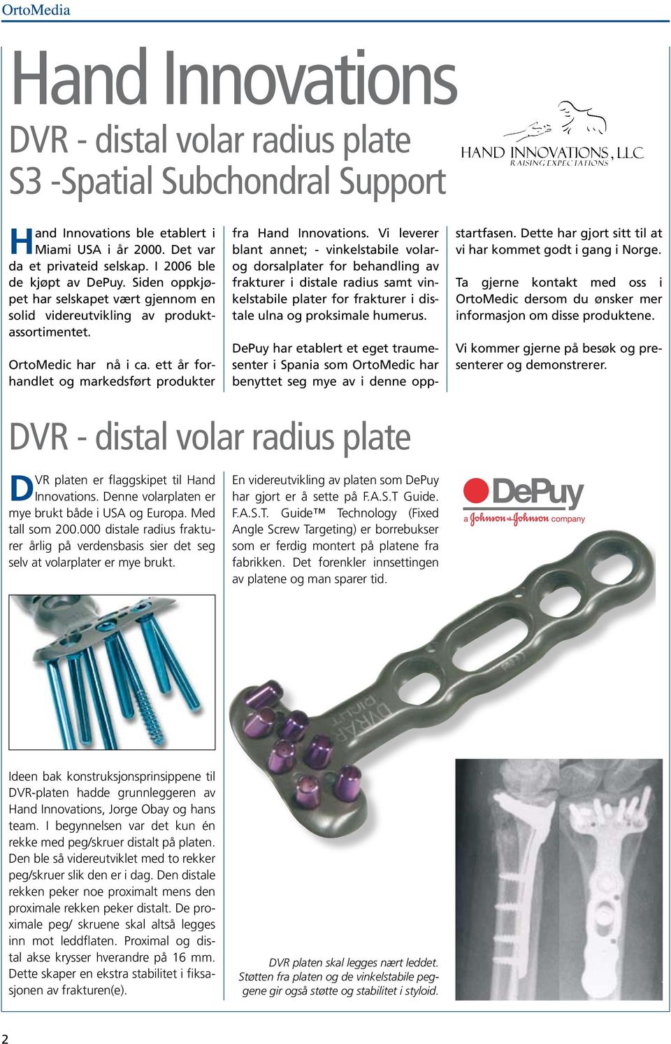 Vi leverer blant annet; - vinkelstabile volarog dorsalplater for behandling av frakturer i distale radius samt vinkelstabile plater for frakturer i distale ulna og proksimale humerus.