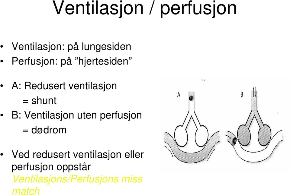 B: Ventilasjon uten perfusjon = dødrom Ved redusert