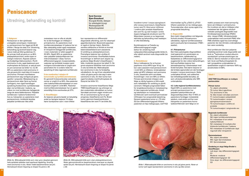 Av primær kreft på penis er ca 95% plateepitelcarcinom; andre typer er malignt melanom, Kaposis sarkom og forskjellige bløtvevsarkom.