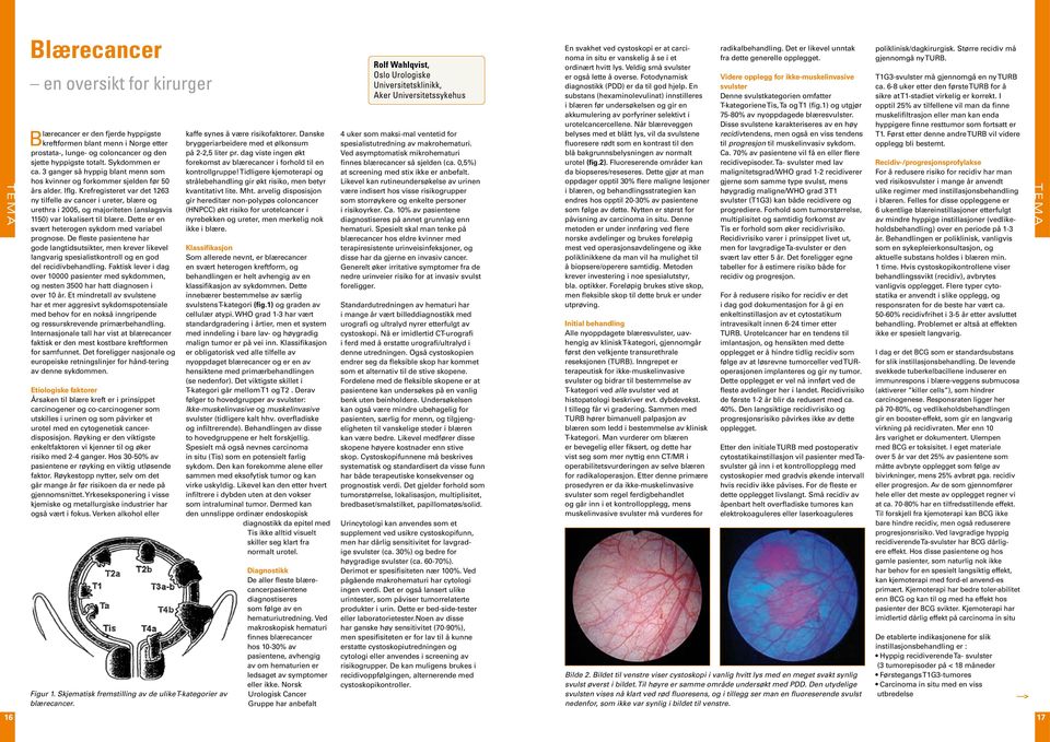 Krefregisteret var det 1263 ny tilfelle av cancer i ureter, blære og urethra i 2005, og majoriteten (anslagsvis 1150) var lokalisert til blære.