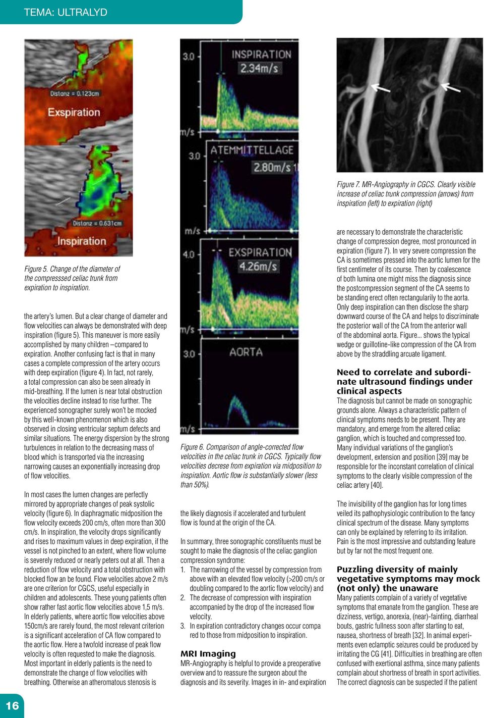 But a clear change of diameter and flow velocities can always be demonstrated with deep inspiration (figure 5). This maneuver is more easily accomplished by many children compared to expiration.