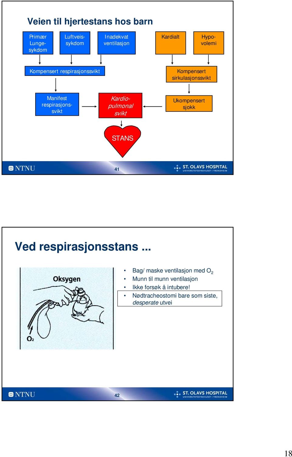 Kardiopulmonal svikt Ukompensert sjokk STANS 41 Ved respirasjonsstans.