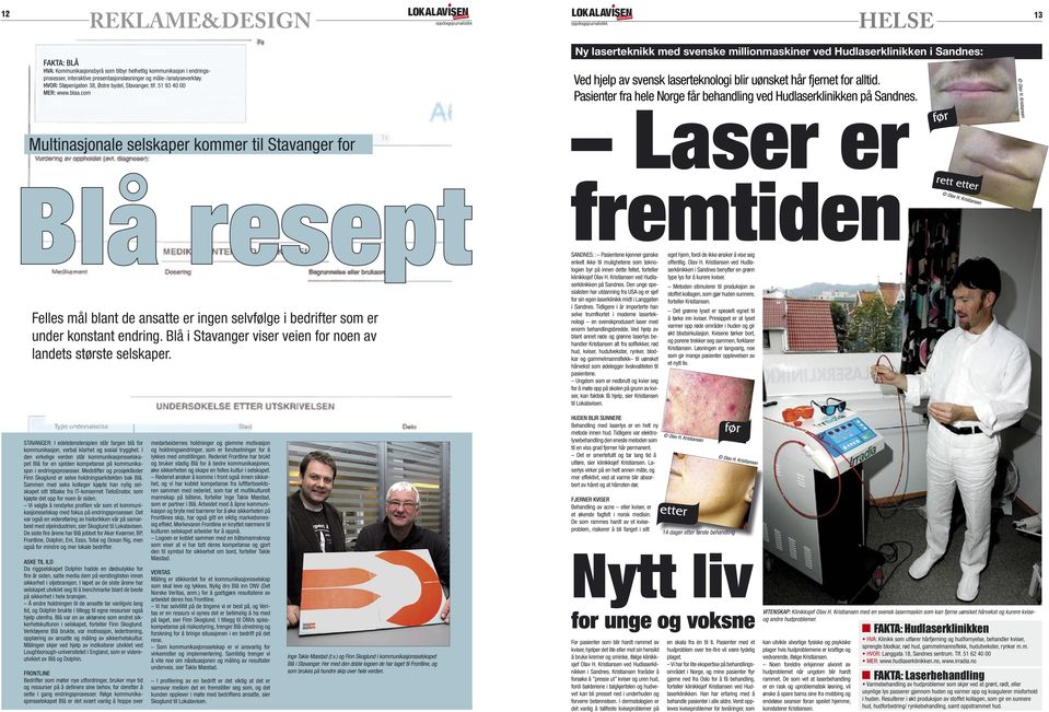 com Ny laserteknikk med svenske millionmaskiner ved Hudlaserklinikken i Sandnes: Ved hjelp av svensk laserteknologi blir uønsket hår fjernet for alltid.