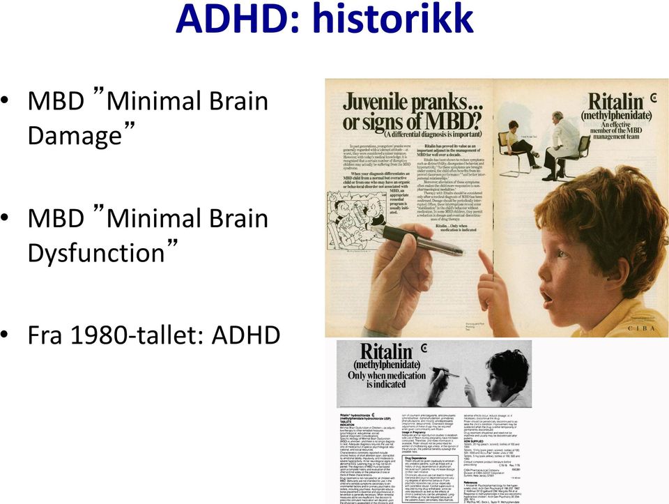 MBD Minimal Brain