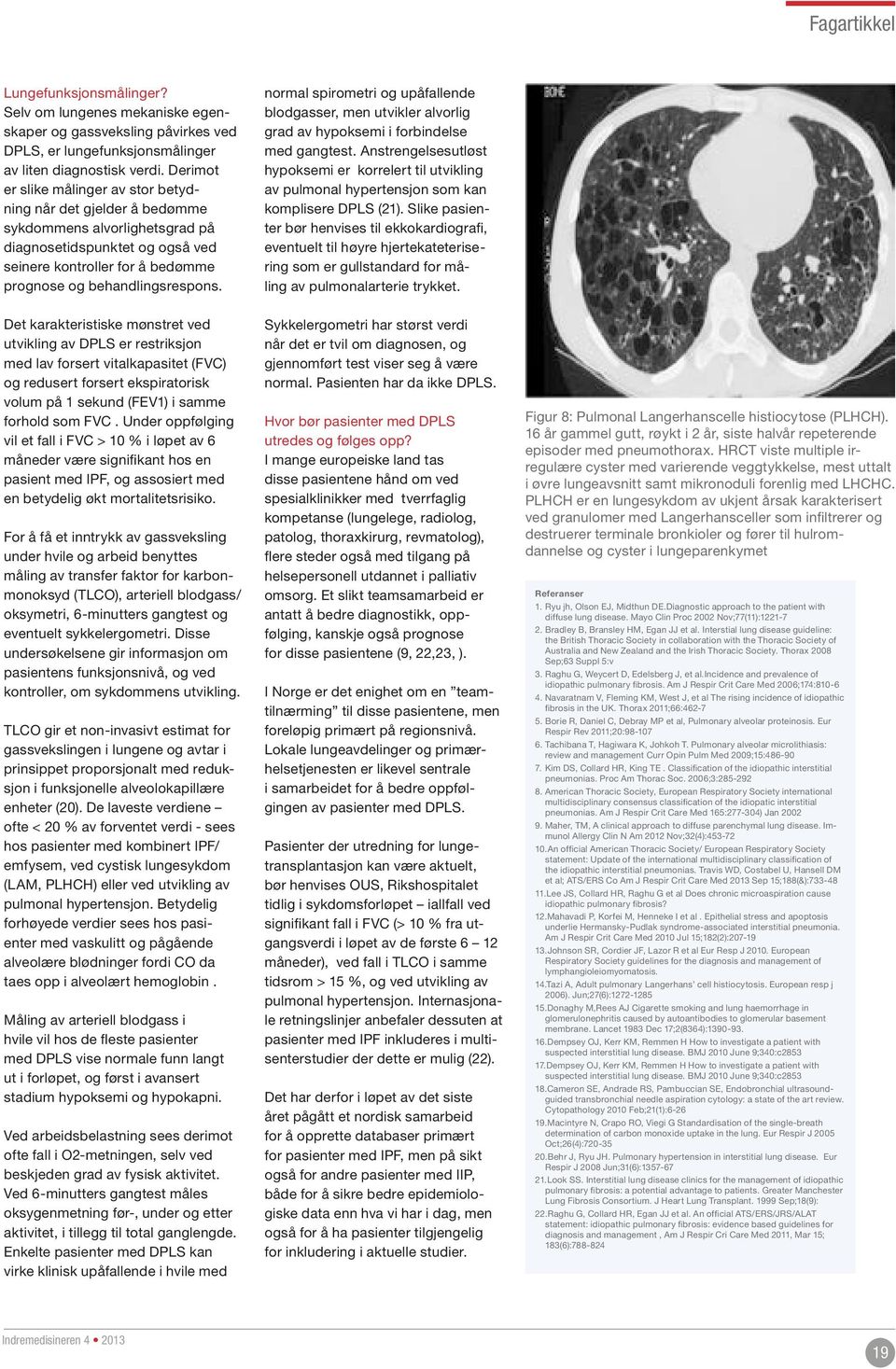 Det karakteristiske mønstret ved utvikling av DPLS er restriksjon med lav forsert vitalkapasitet (FVC) og redusert forsert ekspiratorisk volum på 1 sekund (FEV1) i samme forhold som FVC.