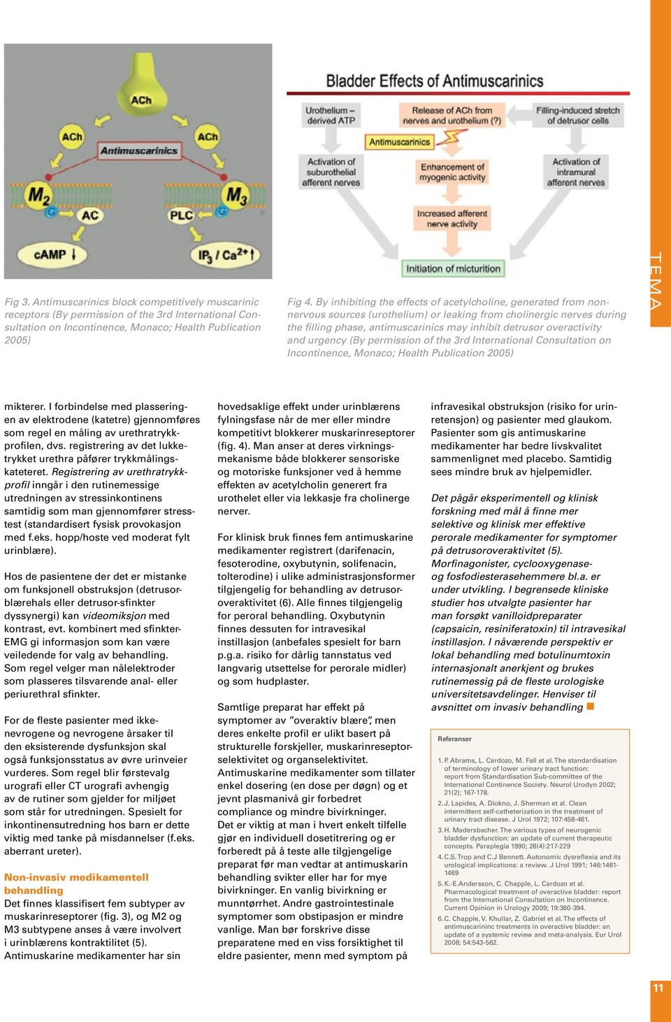 overactivity and urgency (By permission of the 3rd International Consultation on Incontinence, Monaco; Health Publication 2005) TEMA mikterer.