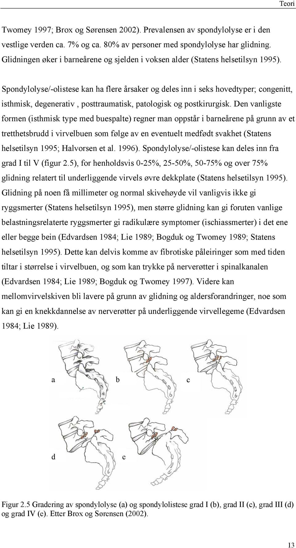 Spondylolyse/-olistese kan ha flere årsaker og deles inn i seks hovedtyper; congenitt, isthmisk, degenerativ, posttraumatisk, patologisk og postkirurgisk.