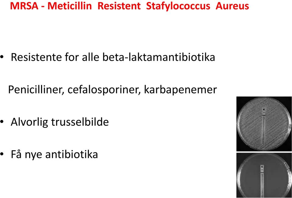 beta-laktamantibiotika Penicilliner,