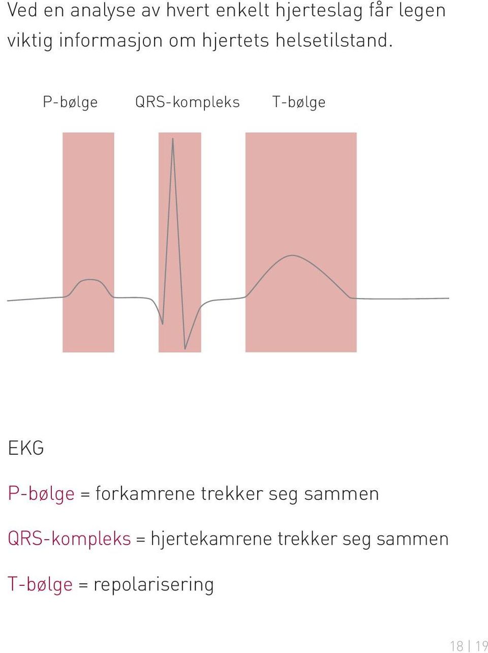 P-bølge QRS-kompleks T-bølge EKG P-bølge = forkamrene trekker