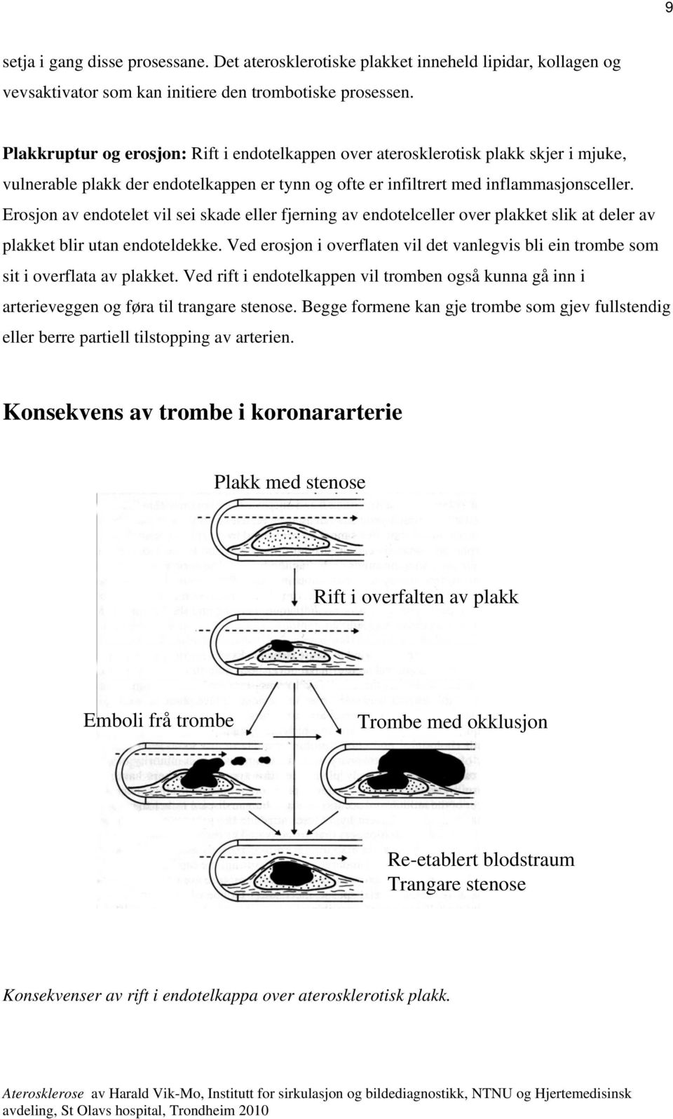 Erosjon av endotelet vil sei skade eller fjerning av endotelceller over plakket slik at deler av plakket blir utan endoteldekke.