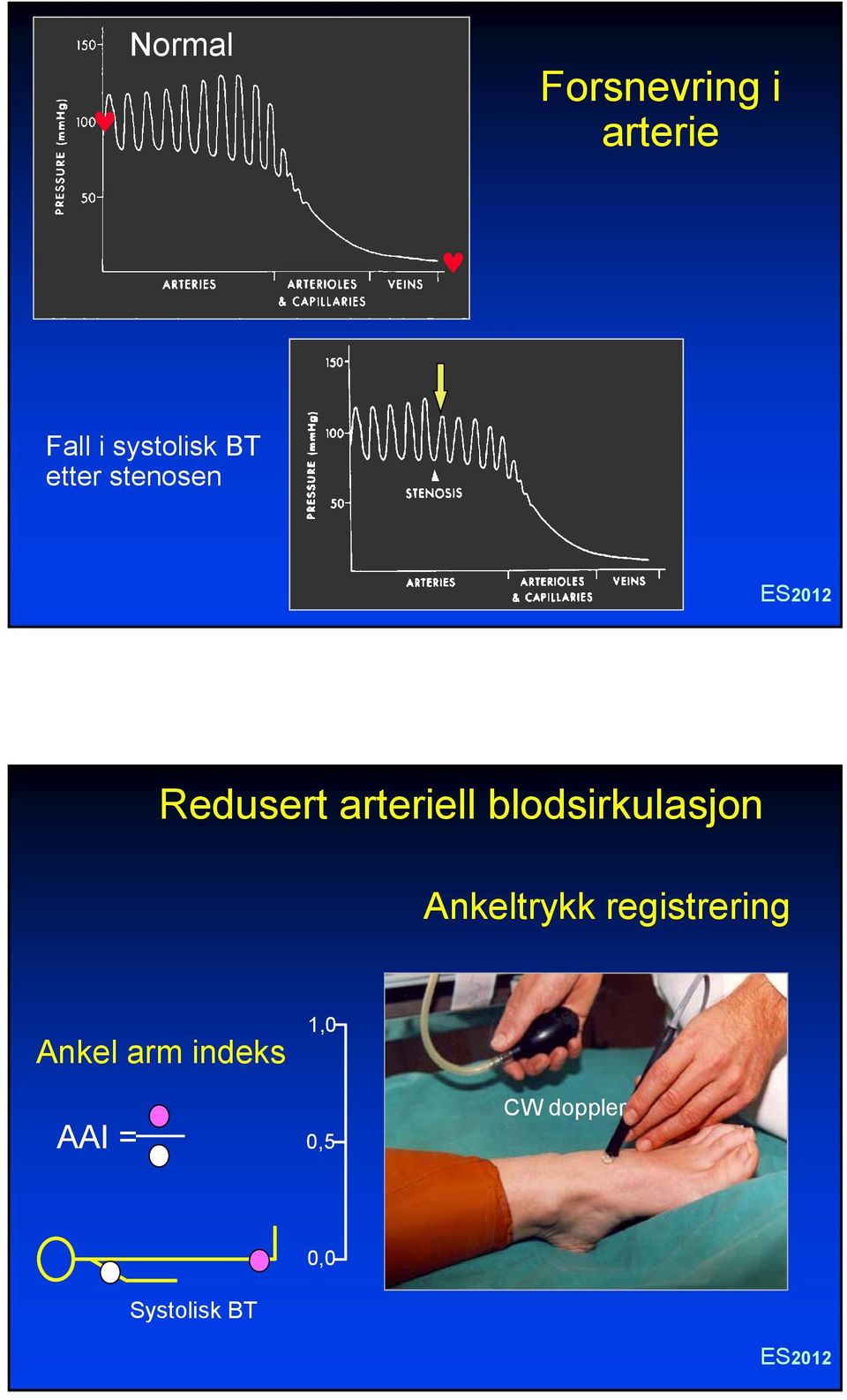 blodsirkulasjon Ankeltrykk registrering Ankel