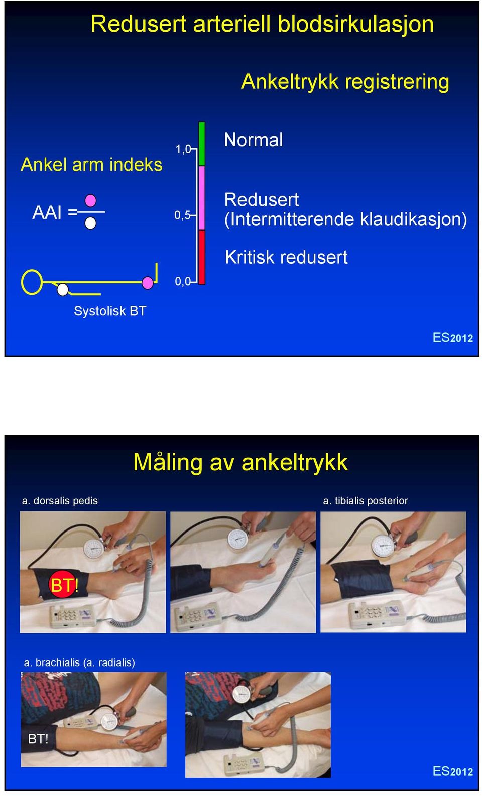 (Intermitterende klaudikasjon) Kritisk redusert Måling av