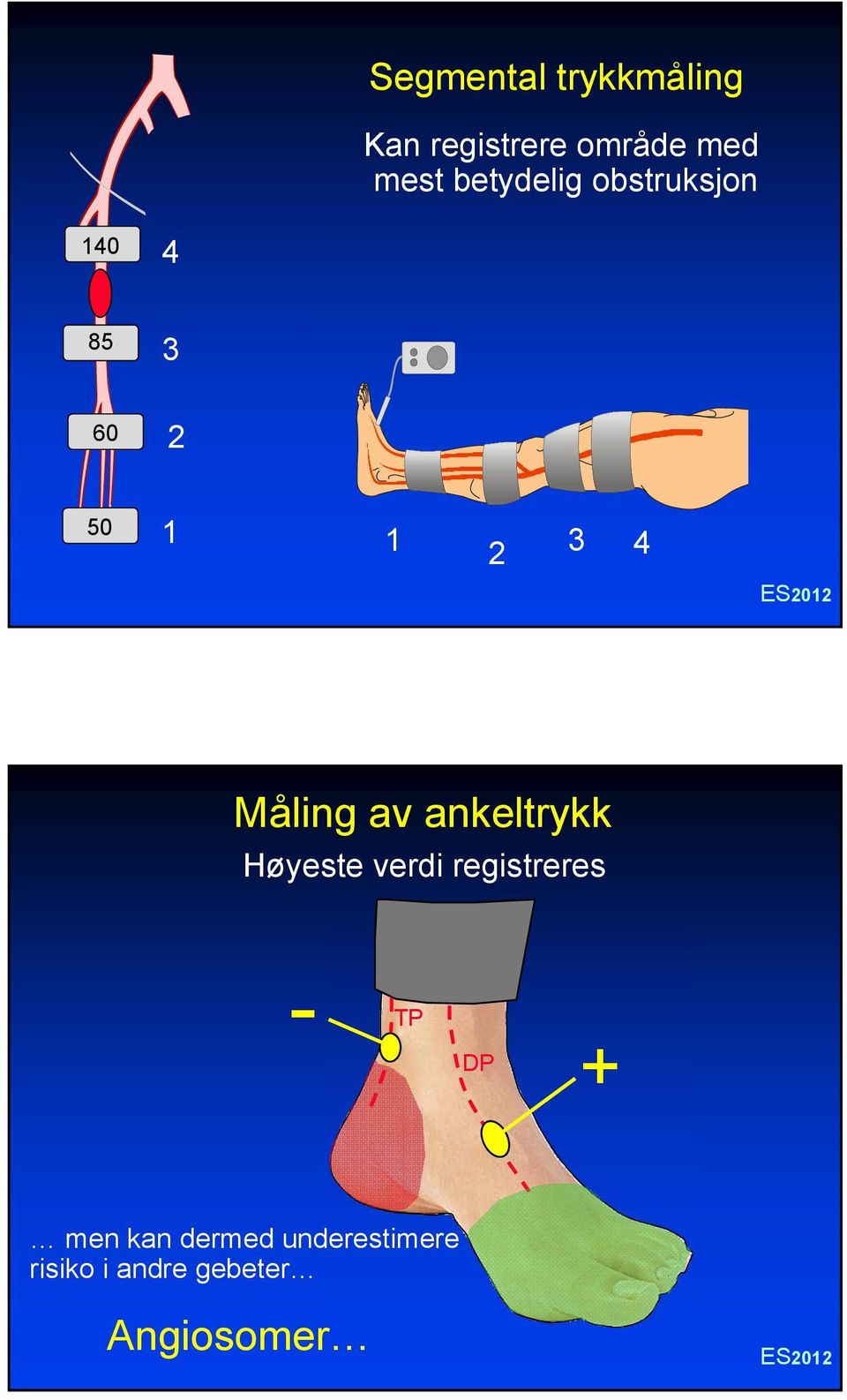 3 4 Måling av ankeltrykk Høyeste verdi registreres - TP DP