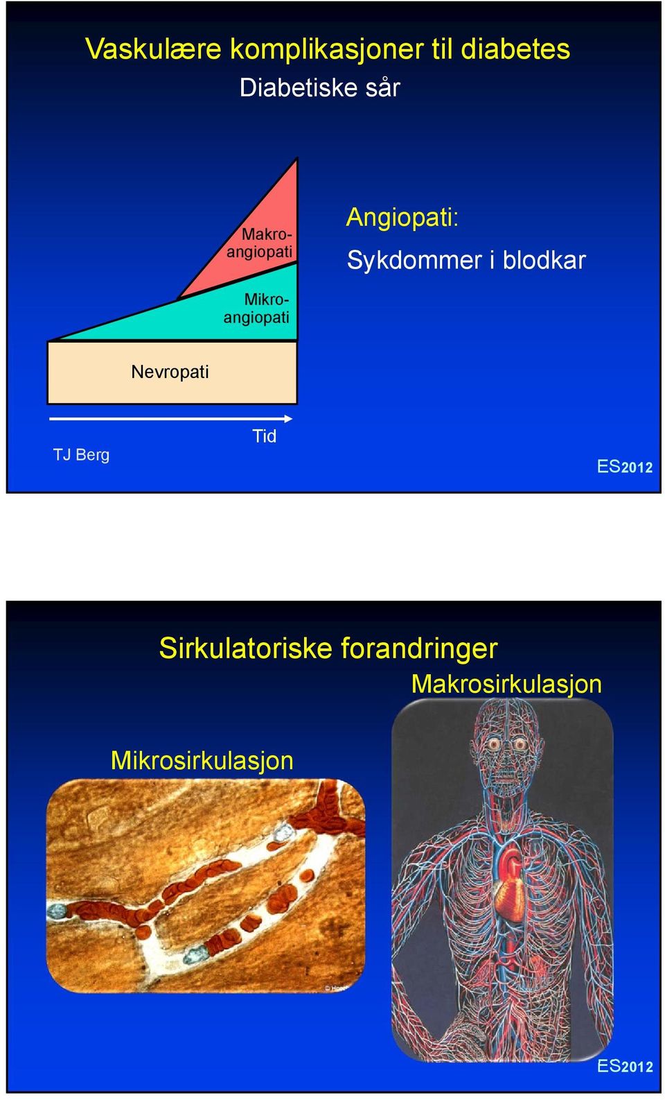 Sykdommer i blodkar Nevropati TJ Berg Tid