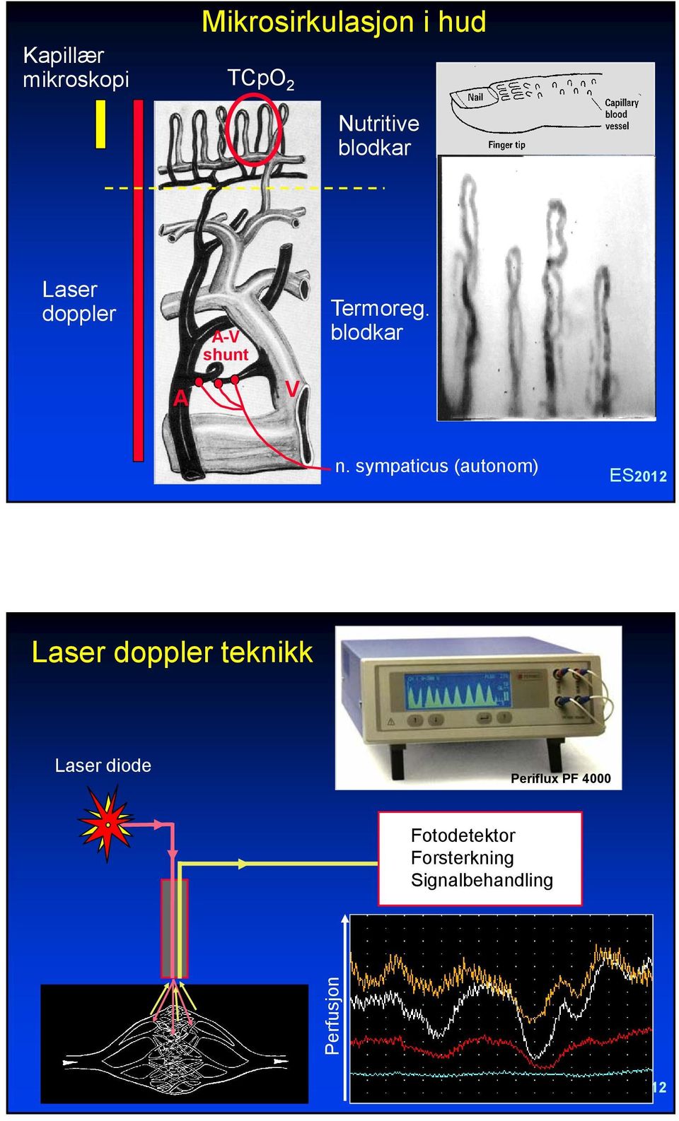 sympaticus (autonom) Laser doppler teknikk Laser diode