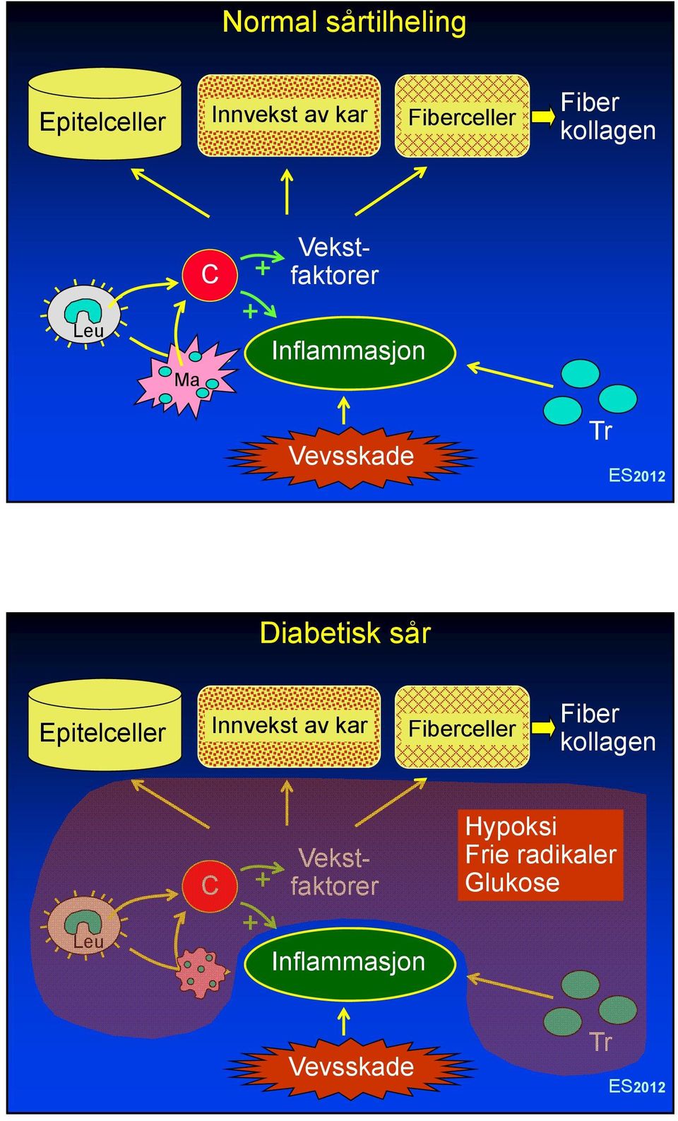 Diabetisk sår Epitelceller Innvekst av kar Fiberceller Fiber kollagen