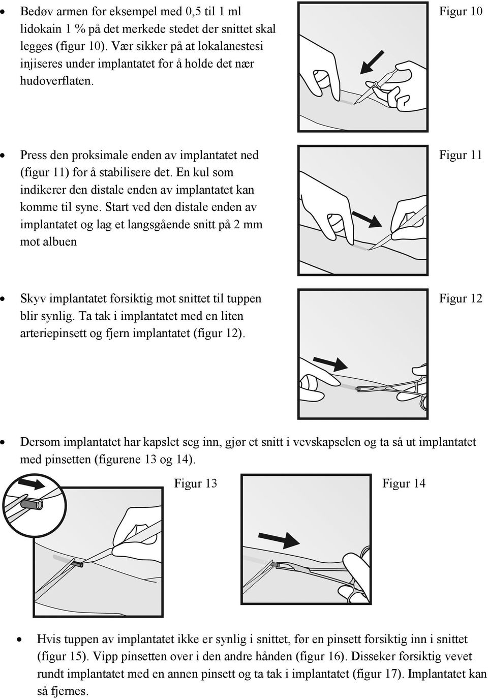 En kul som indikerer den distale enden av implantatet kan komme til syne.