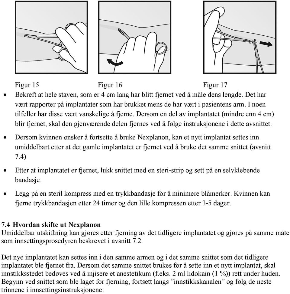 Dersom kvinnen ønsker å fortsette å bruke Nexplanon, kan et nytt implantat settes inn umiddelbart etter at det gamle implantatet er fjernet ved å bruke det samme snittet (avsnitt 7.