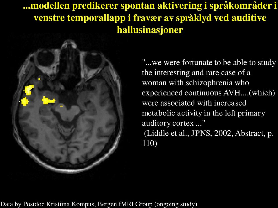 ..we were fortunate to be able to study the interesting and rare case of a woman with schizophrenia who experienced