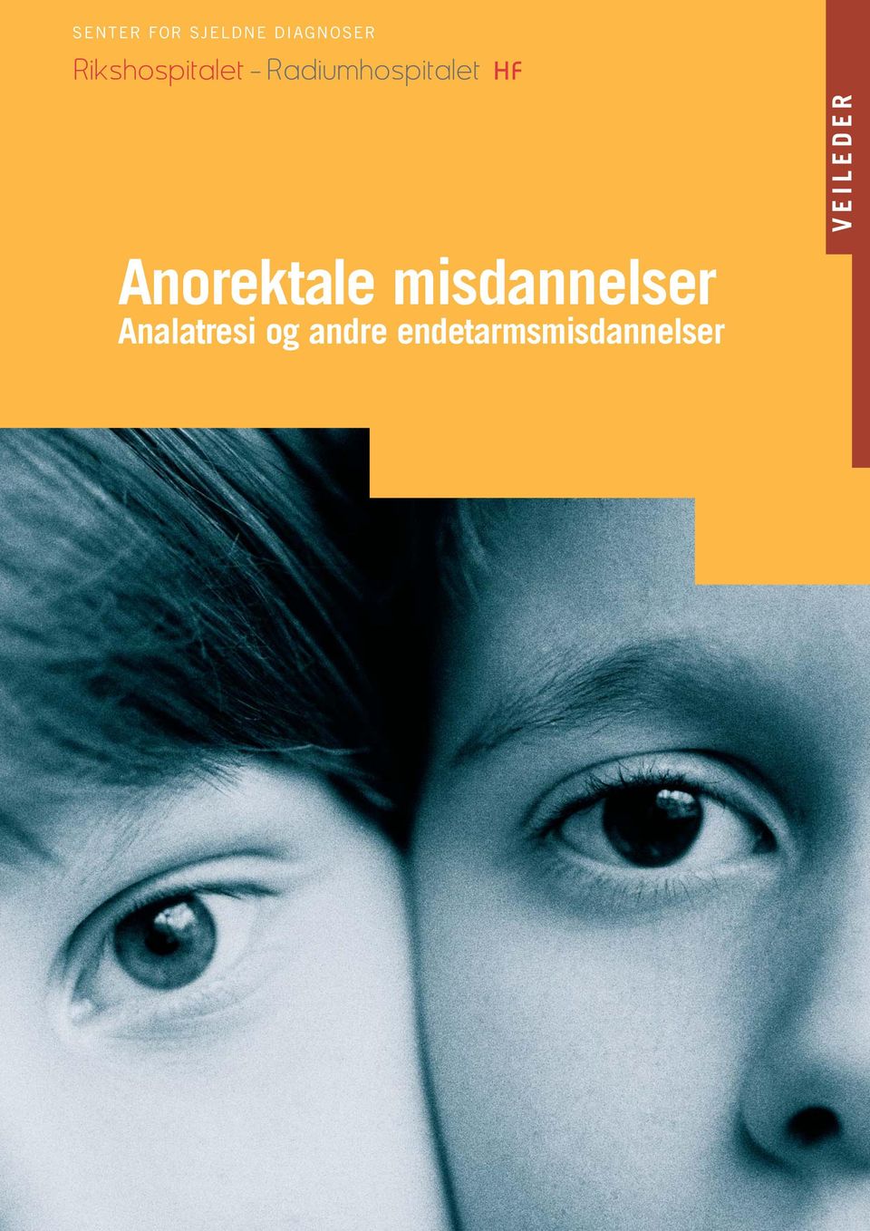 Anorektale misdannelser