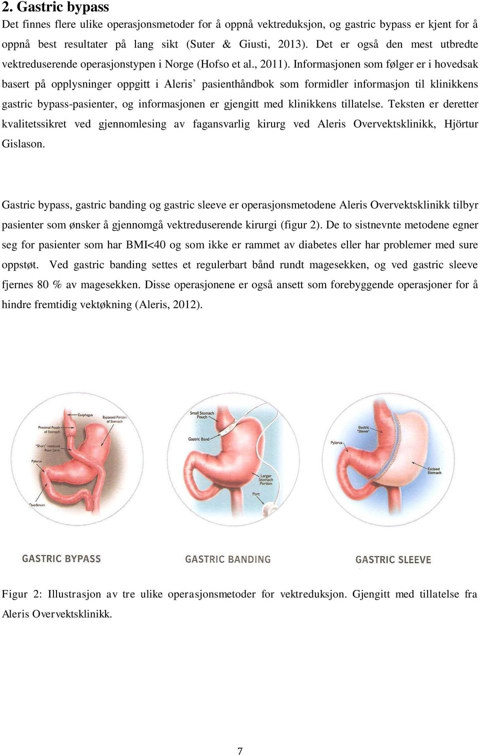 Informasjonen som følger er i hovedsak basert på opplysninger oppgitt i Aleris pasienthåndbok som formidler informasjon til klinikkens gastric bypass-pasienter, og informasjonen er gjengitt med