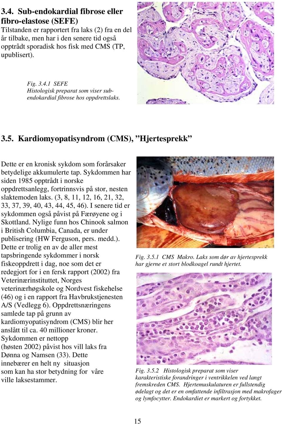 Kardiomyopatisyndrom (CMS), Hjertesprekk Dette er en kronisk sykdom som forårsaker betydelige akkumulerte tap.