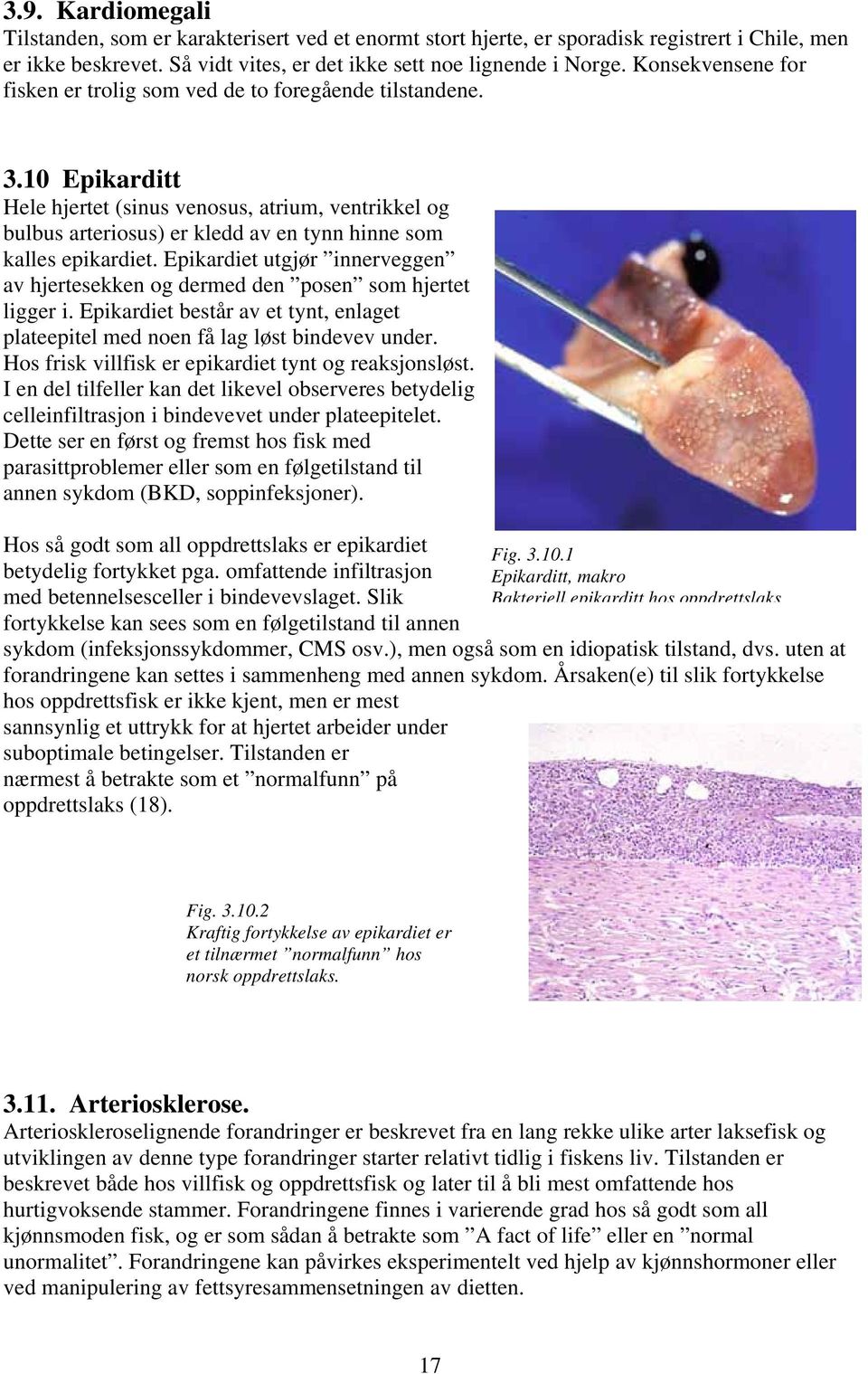 10 Epikarditt Hele hjertet (sinus venosus, atrium, ventrikkel og bulbus arteriosus) er kledd av en tynn hinne som kalles epikardiet.