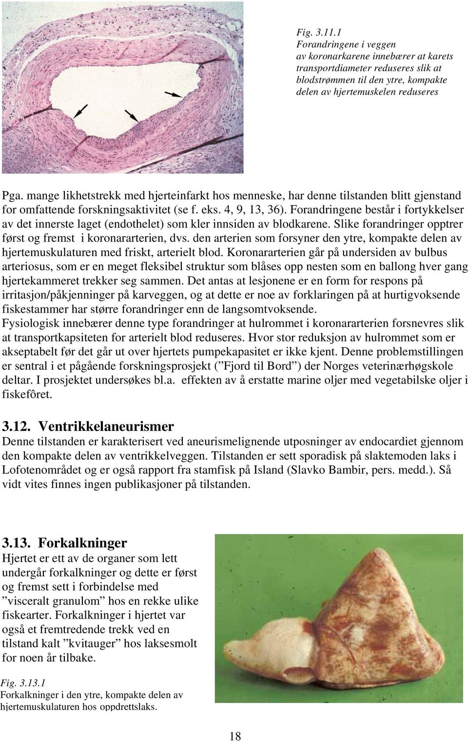 Forandringene består i fortykkelser av det innerste laget (endothelet) som kler innsiden av blodkarene. Slike forandringer opptrer først og fremst i koronararterien, dvs.