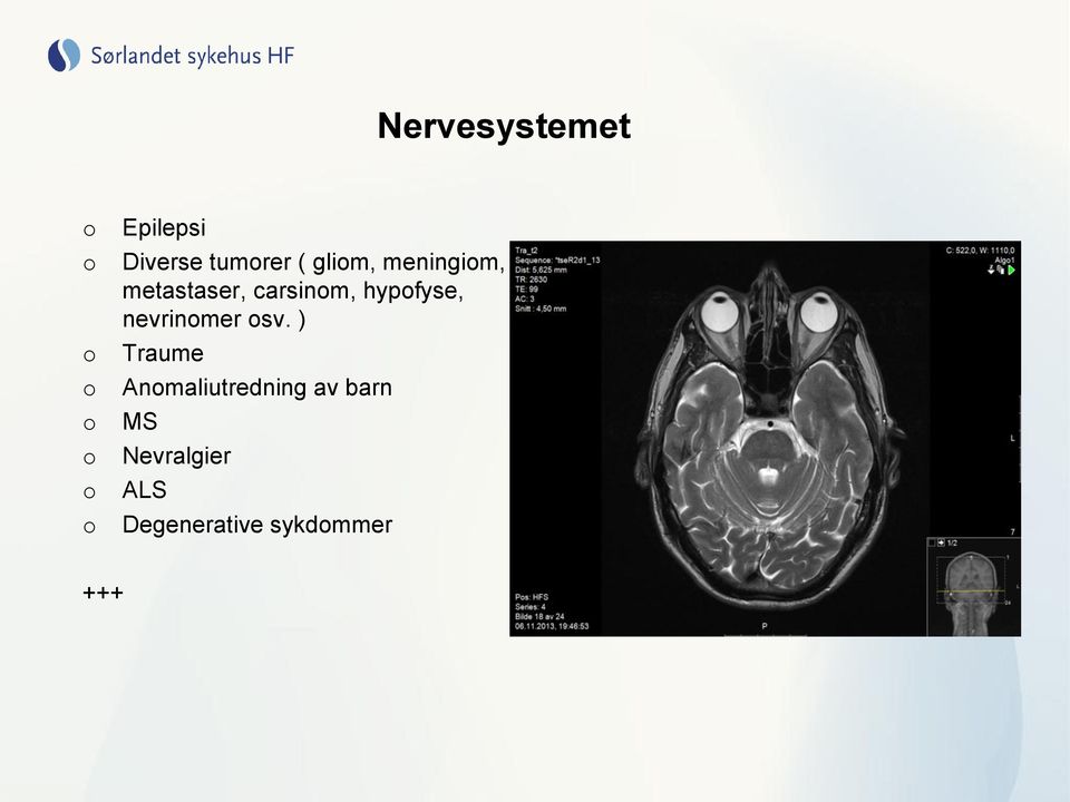 hypofyse, nevrinomer osv.