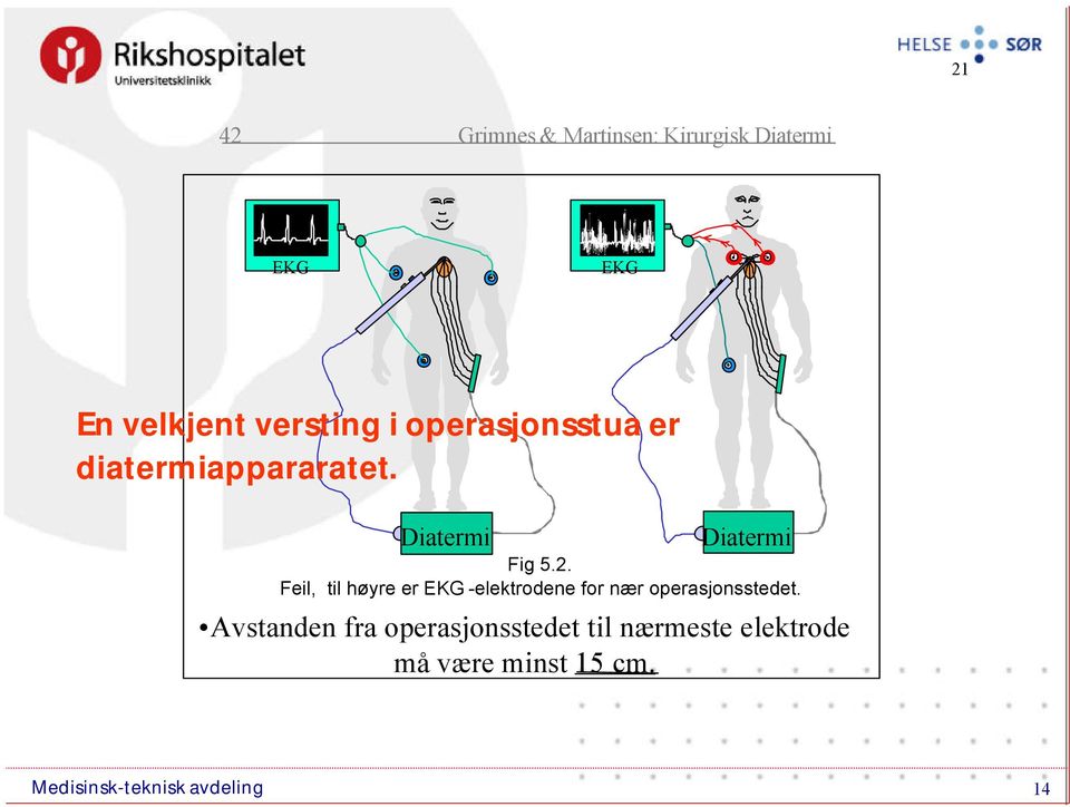 Diatermi Diatermi Fig 5.2.