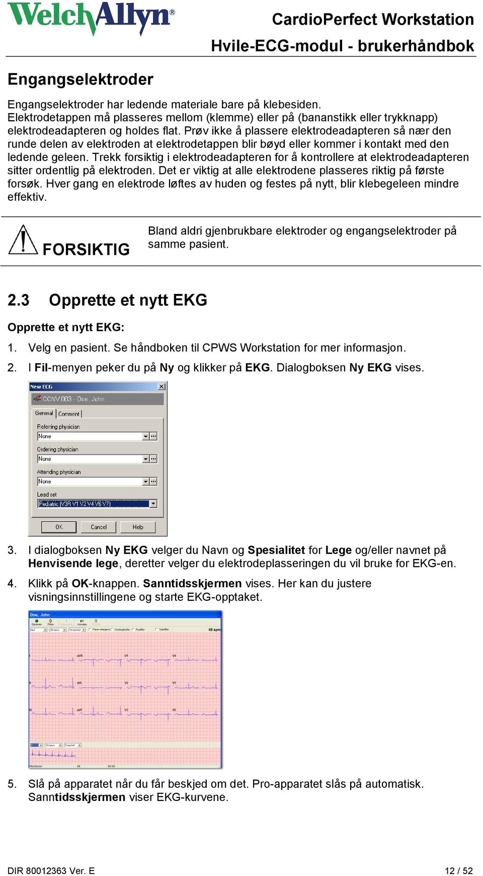 Trekk forsiktig i elektrodeadapteren for å kontrollere at elektrodeadapteren sitter ordentlig på elektroden. Det er viktig at alle elektrodene plasseres riktig på første forsøk.