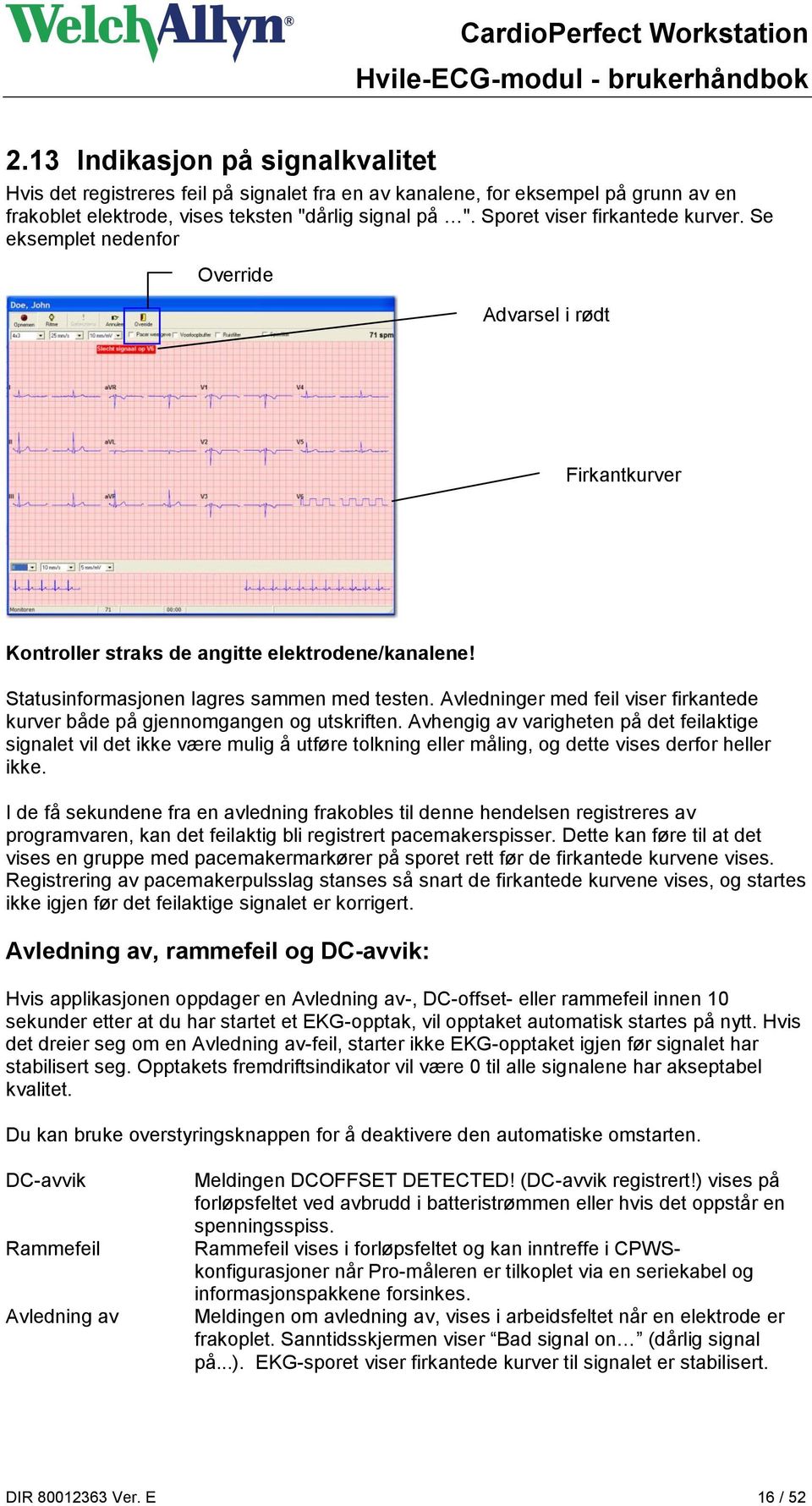 Avledninger med feil viser firkantede kurver både på gjennomgangen og utskriften.