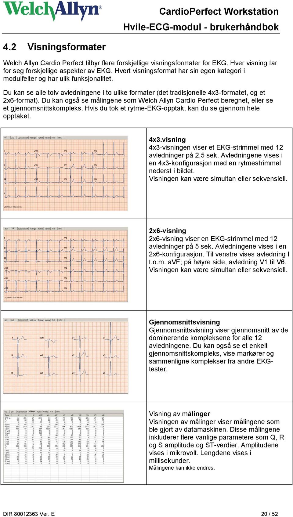 Du kan også se målingene som Welch Allyn Cardio Perfect beregnet, eller se et gjennomsnittskompleks. Hvis du tok et rytme-ekg-opptak, kan du se gjennom hele opptaket. 4x3.