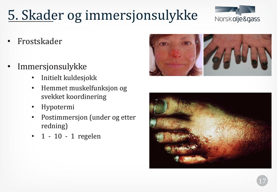 muskelfunksjon og svekket koordinering Hypotermi